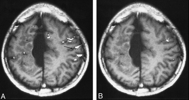 fig 1.
