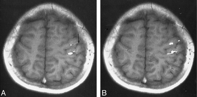 fig 2.