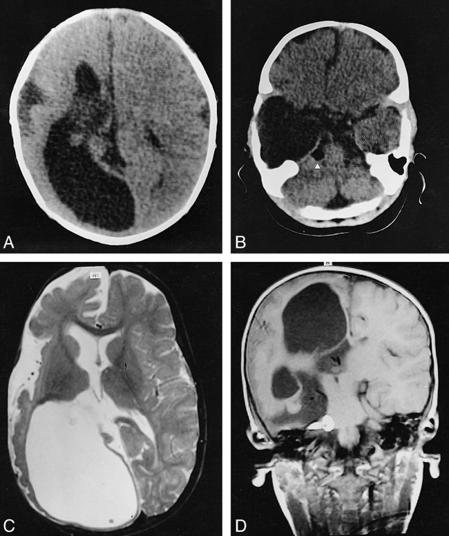 fig 1.