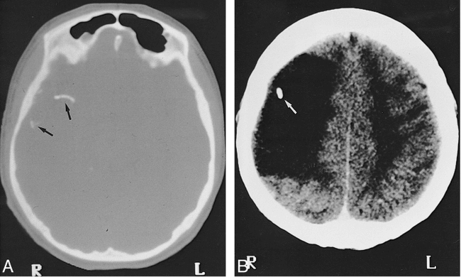 fig 1.