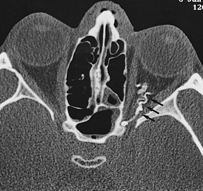 fig 2.