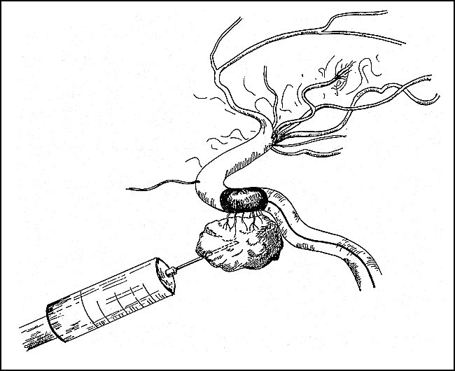 fig 3.