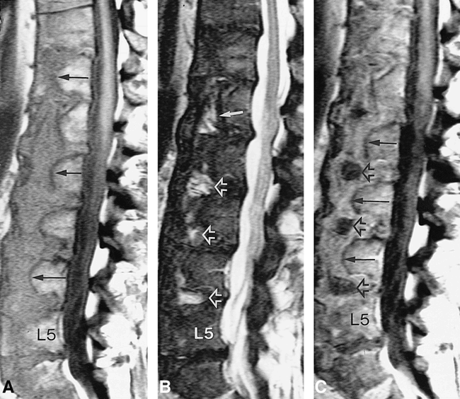 fig 1.