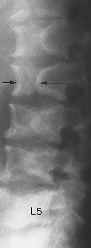 fig 2.