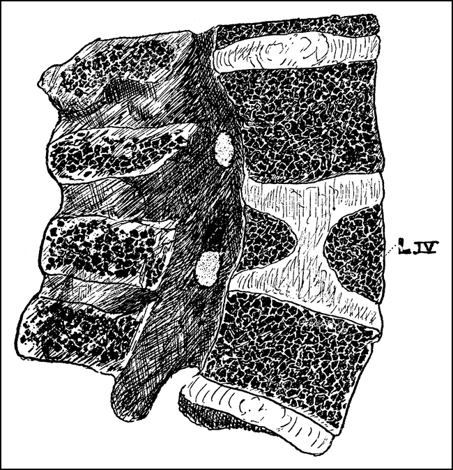 fig 3.