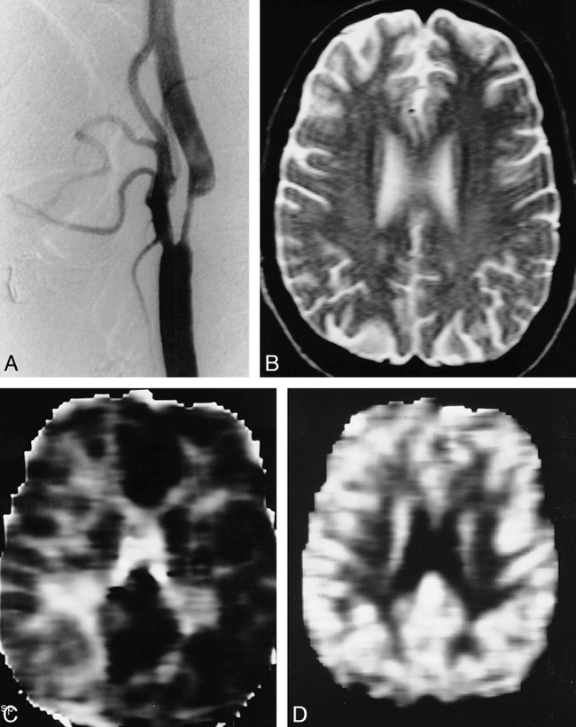 fig 2.