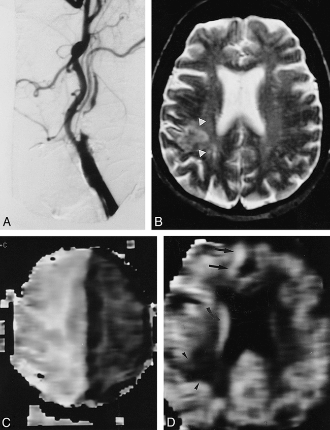 fig 3.
