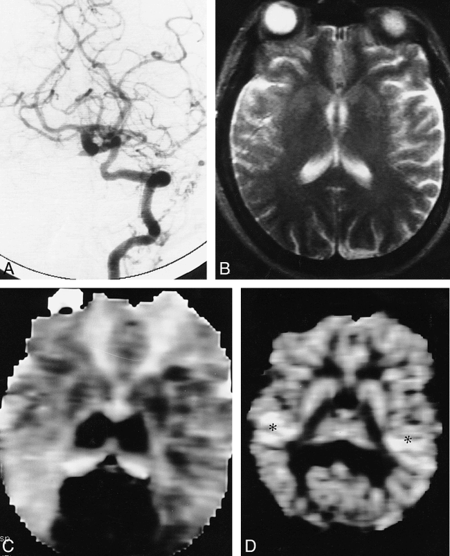 fig 4.