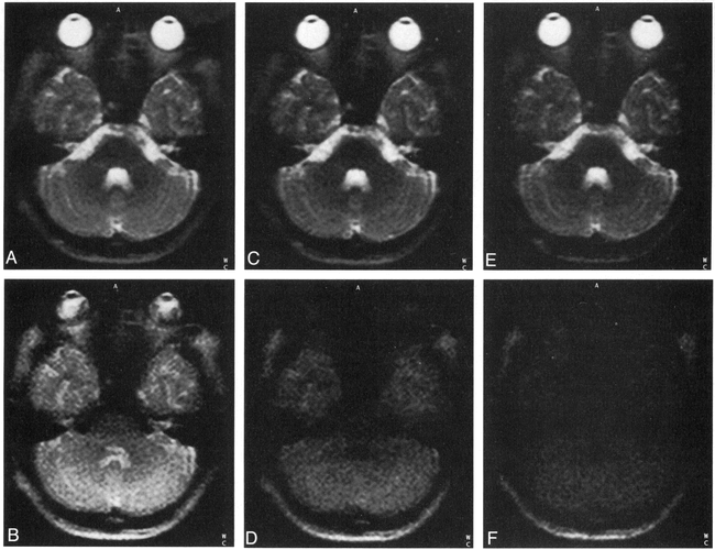 fig 3.