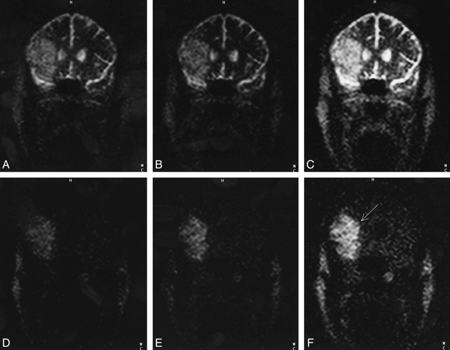 fig 4.