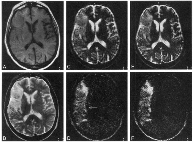 fig 5.