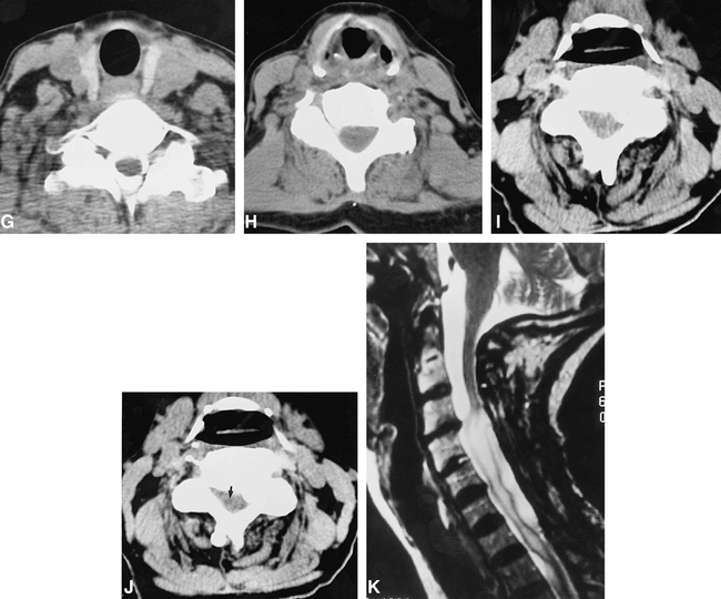 fig 2.