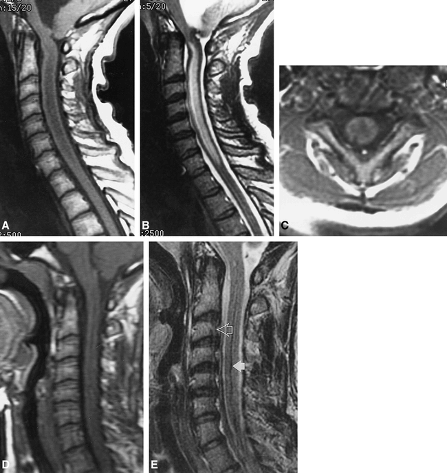 fig 3.