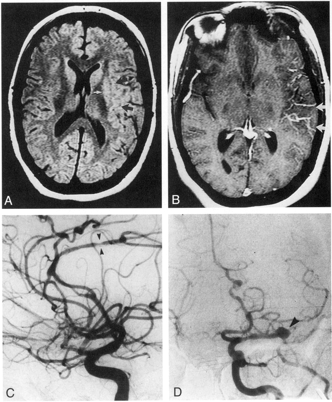 fig 6.
