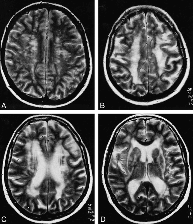 fig 1.