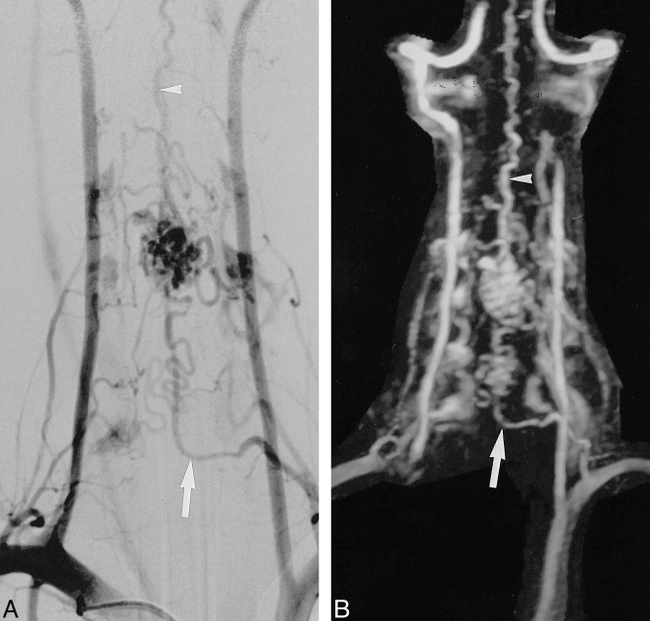 fig 2.