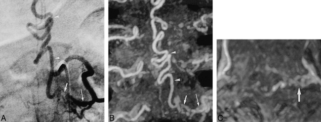 fig 4.
