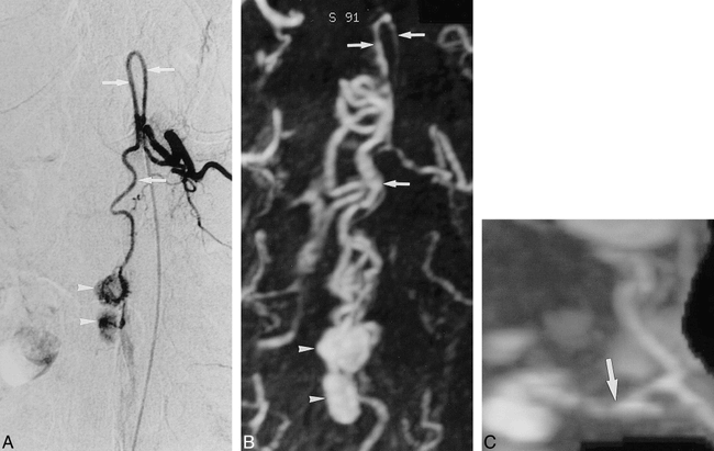 fig 5.