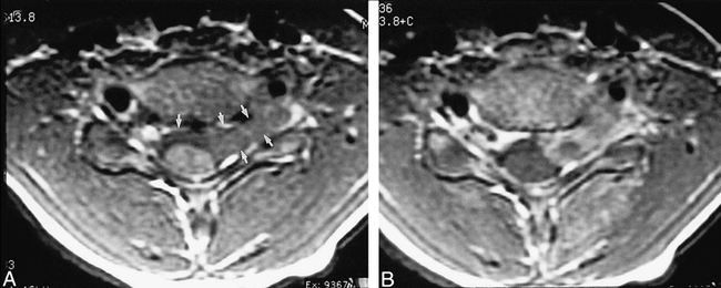 fig 6.