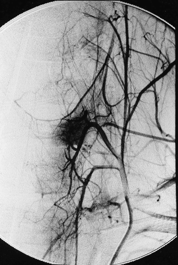 fig 7.