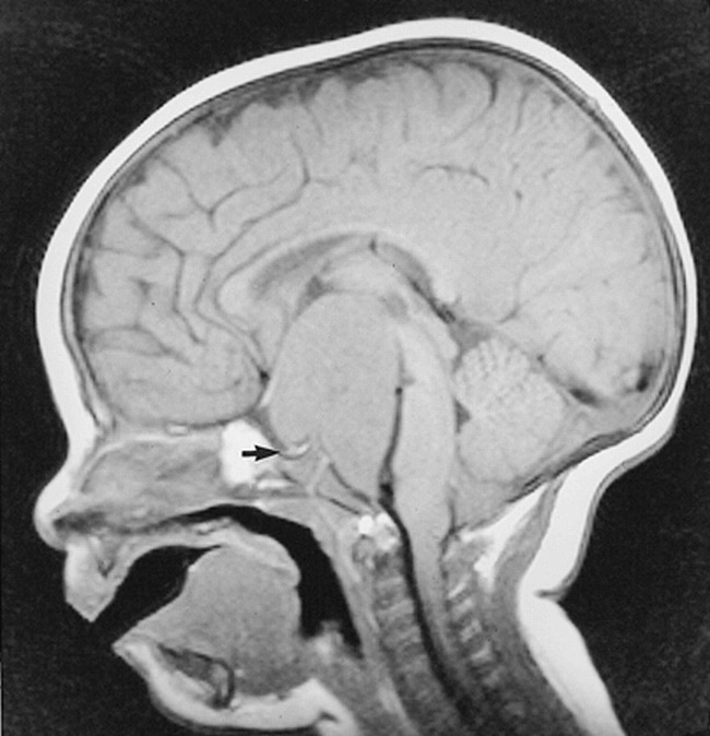 fig 3.