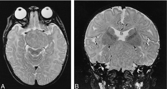 fig 4.