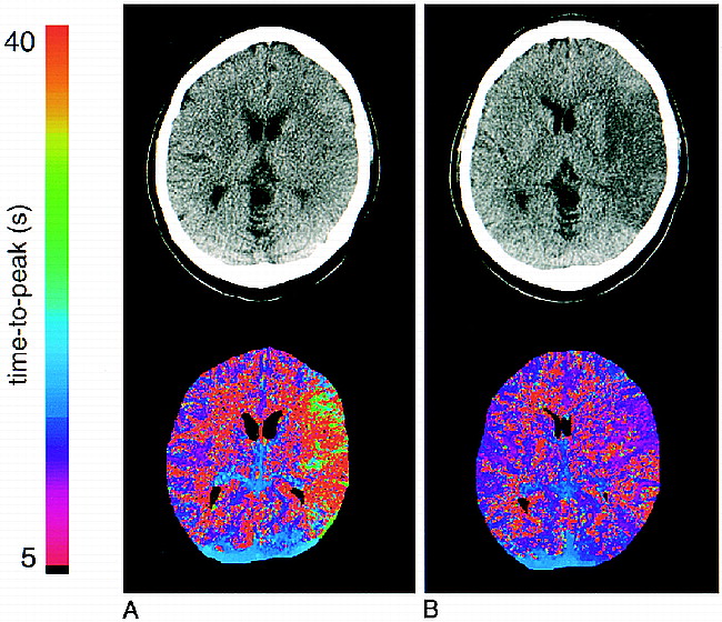 fig 3.