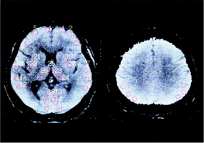 fig 1.