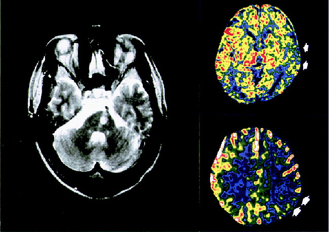 fig 2.