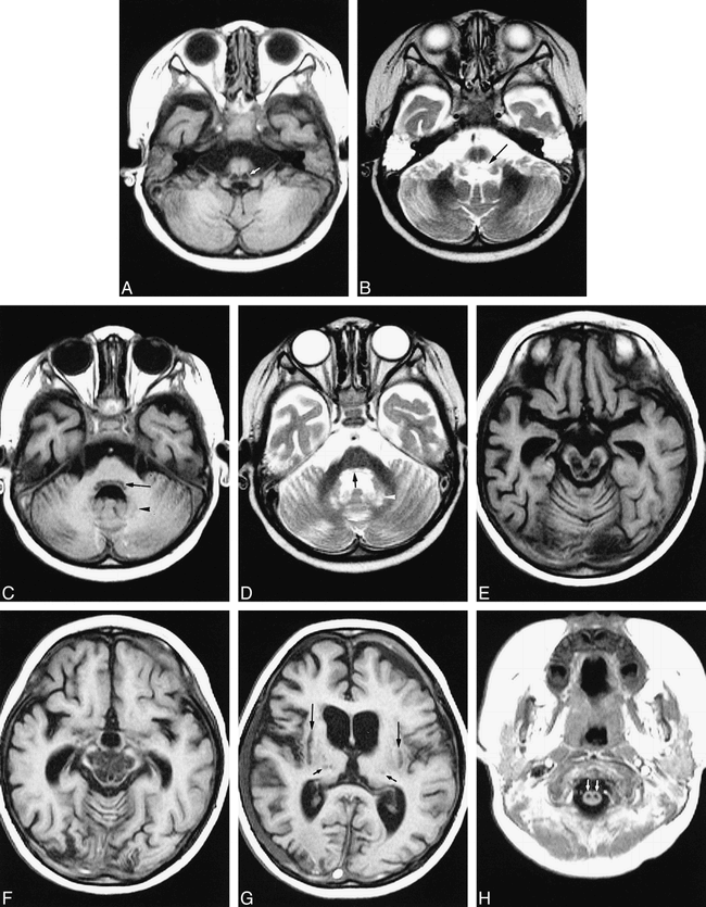 fig 3.