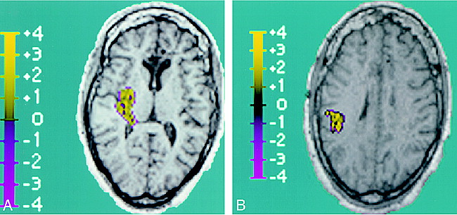 fig 3.