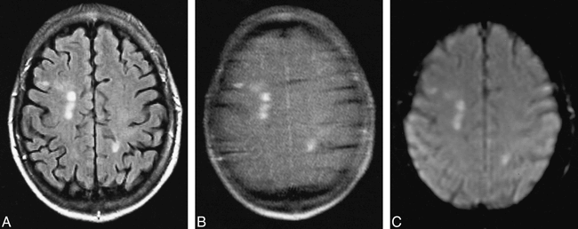 fig 1.