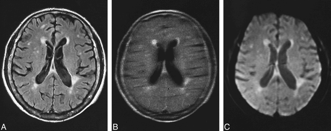 fig 2.