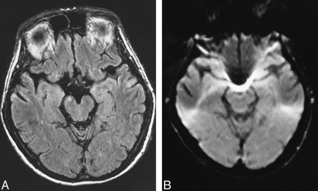 fig 3.