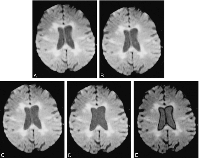 fig 4.