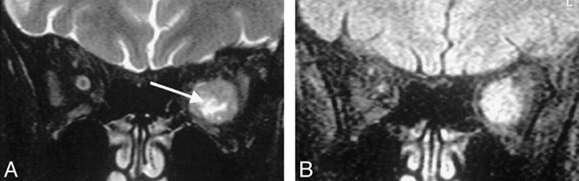fig 5.