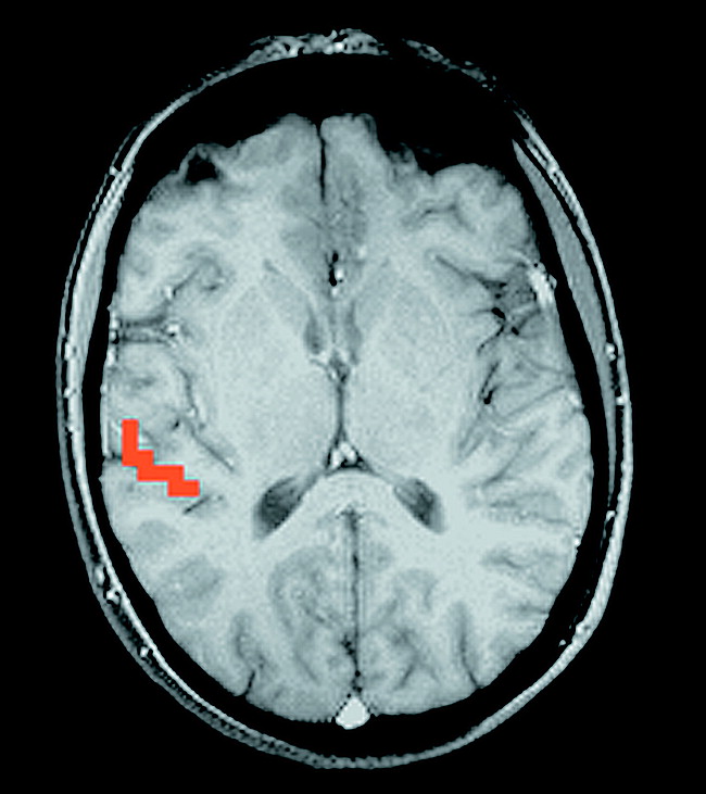 fig 2.