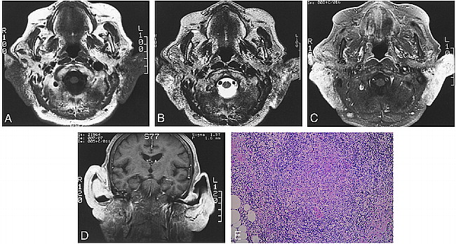 fig 1.