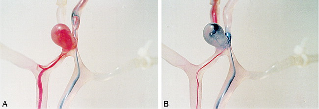 fig 4.