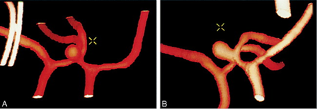 fig 5.