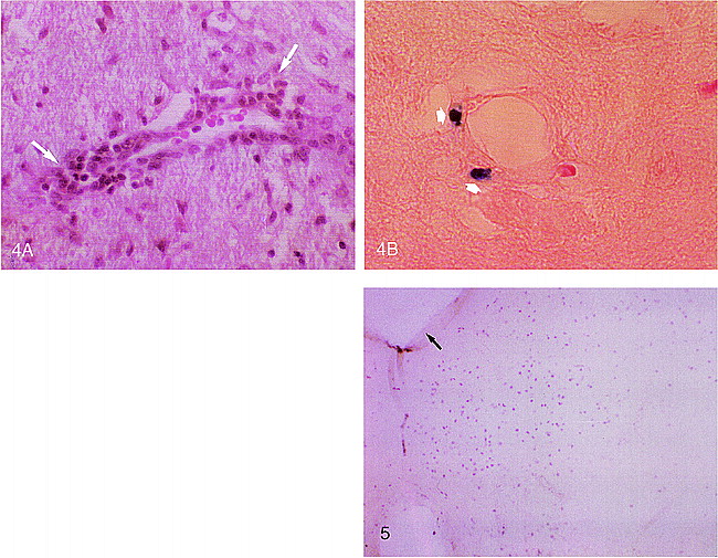 fig 4.