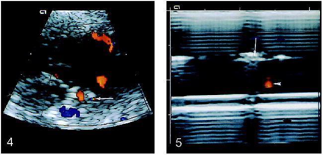 fig 4.