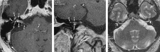 fig 1.