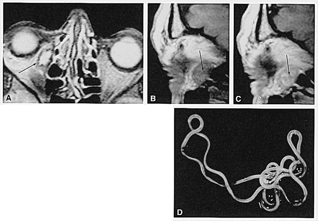 fig 1.