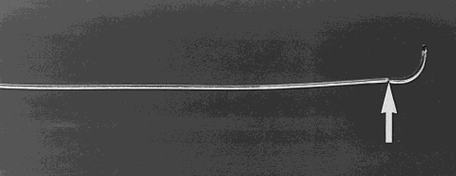 fig 1.