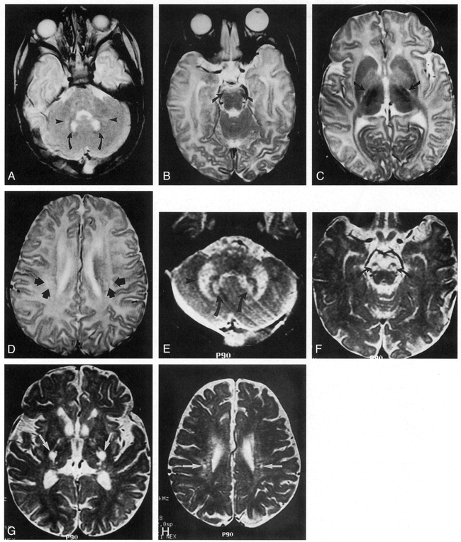 fig 2.