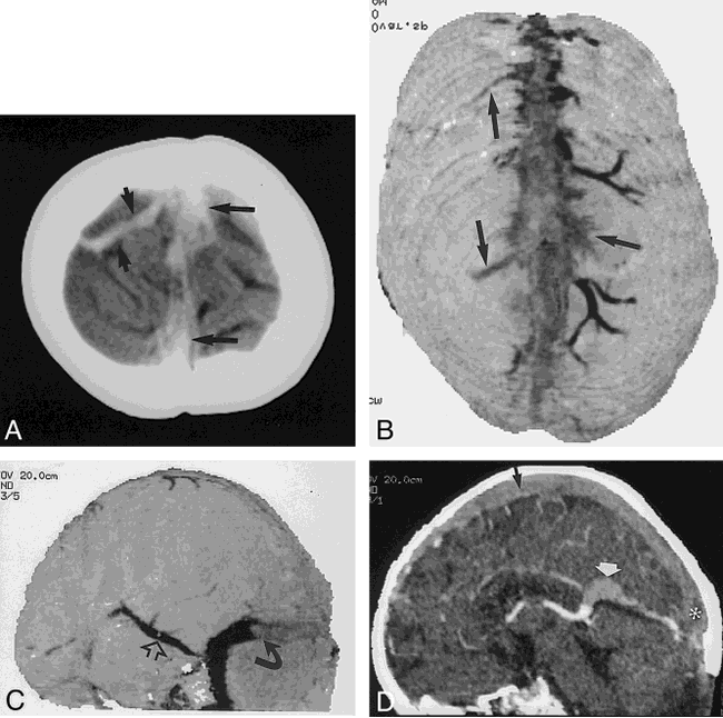 fig 2.