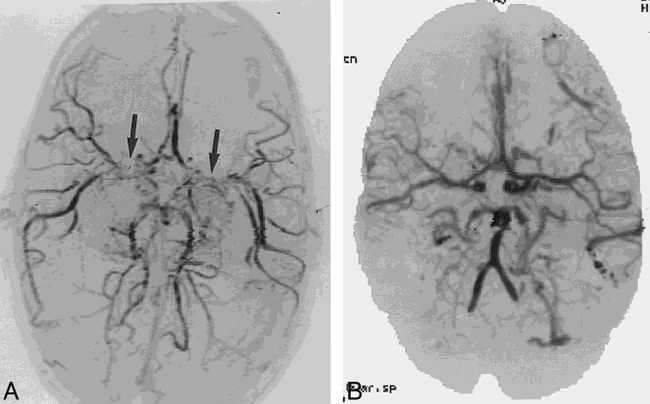 fig 4.