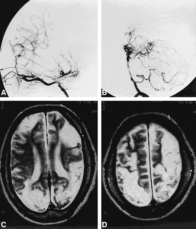 fig 4.