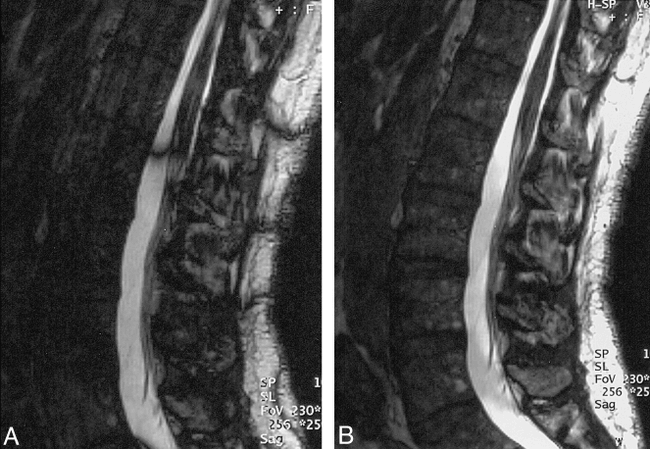 fig 13.